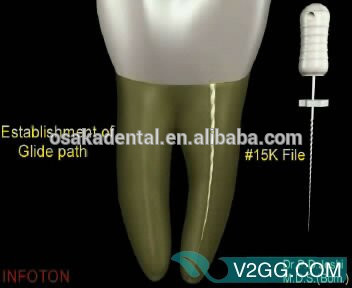OSAKA DENTAL Pas cher prix K Fichiers handuse bonne qualité Fichier Canal Radiculaire / Instrument chirurgical dentaire avec CE