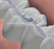 Équipement dentaire numérique Amalgamator F101 dentaire / avec CE approuvé