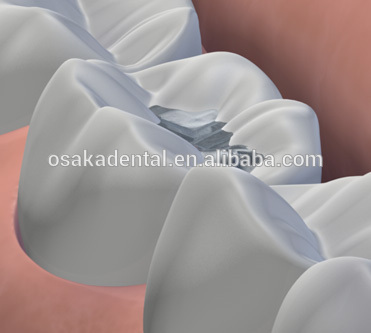 Équipement dentaire numérique Amalgamator F101 dentaire / avec CE approuvé