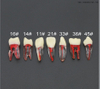 Modèle de dents de pratique à l'usage des étudiants dentistes